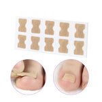 Ingrown Toe Nail Fixer Pedicure Recover Embed Toenail Correction Lifter Tool Set